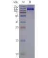 page-flp120323 grm3 strep sp1