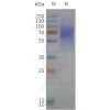page-flp120334 lpar1 strep sp1