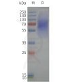 page-flp120334 lpar1 strep sp1
