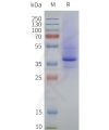 page-flp120335 lpar2 strep sp1