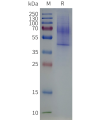 page-flp120336 lpar3 strep sp1