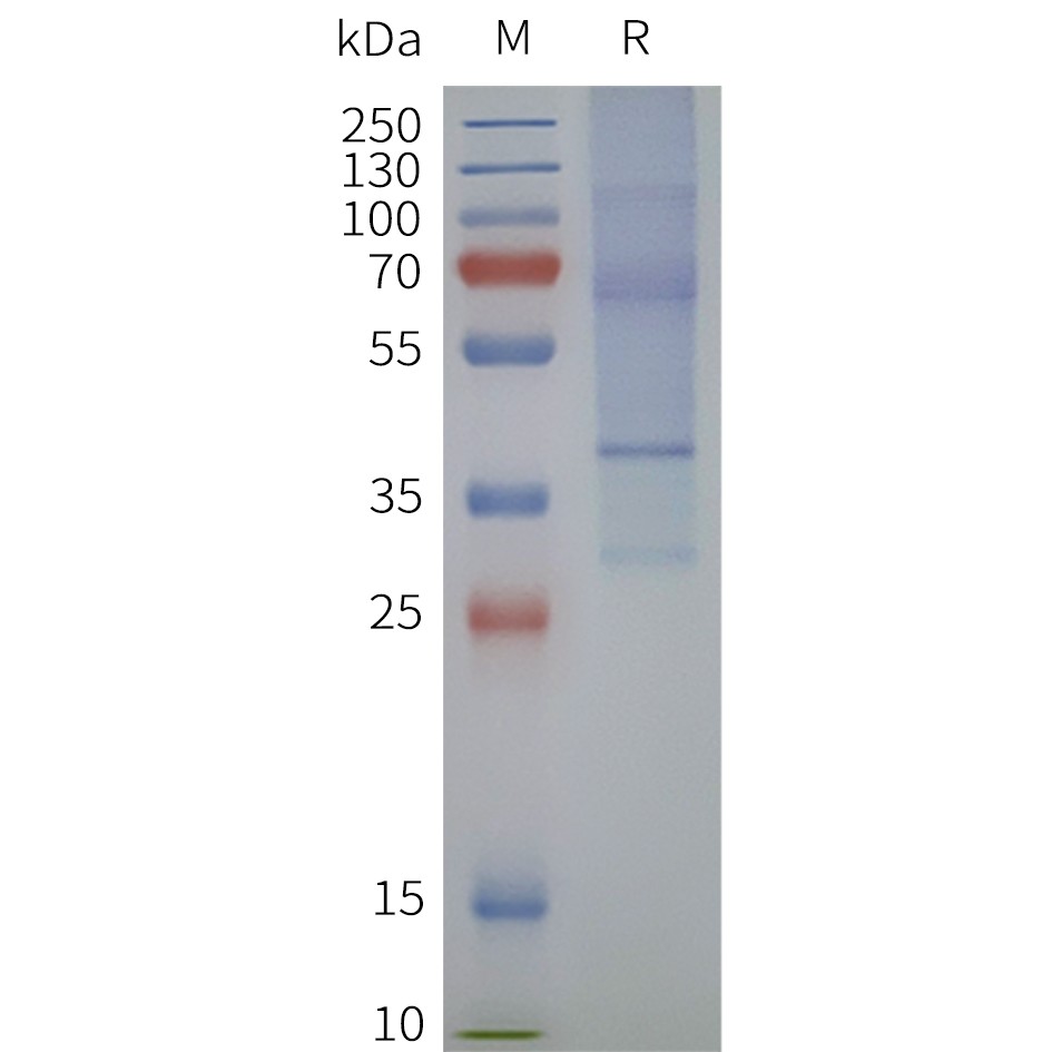 flp120338-lpar5-strep-sp1.jpg