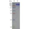 page-flp120340 lshr strep sp1