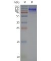 page-flp120340 lshr strep sp1