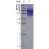 page-flp120341 ltb4r strep sp1