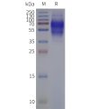 page-flp120341 ltb4r strep sp1