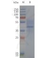 page-flp120345 mc3r strep sp1