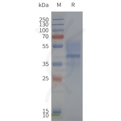 page-flp120345 mc3r strep sp1