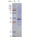 page-flp120354 mc1r strep sp1