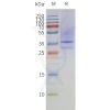 page-flp120356 mtr1a strep sp1