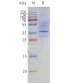 page-flp120356 mtr1a strep sp1