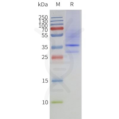 page-flp120356 mtr1a strep sp1