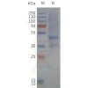 page-flp120357 mtr1b strep sp1