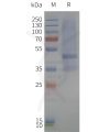 page-flp120357 mtr1b strep sp1