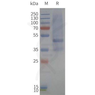 page-flp120357 mtr1b strep sp1