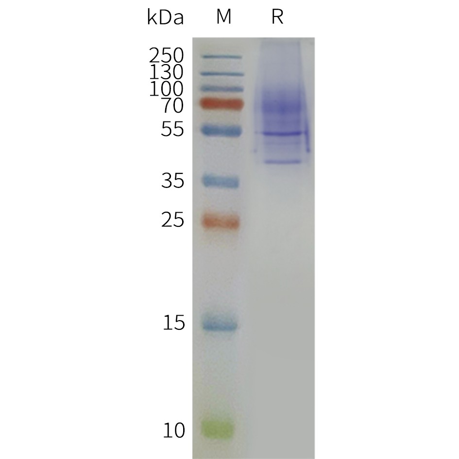 flp120361-nk3r-strep-sp1.jpg
