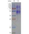 page-flp120370 npy1r strep sp1