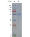page-flp120371 npy2r strep sp1
