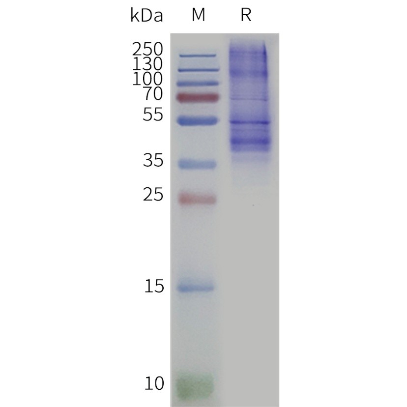 flp120379-opn3-strep-sp1.jpg