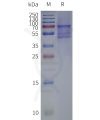 page-flp120380 opn4 strep sp1