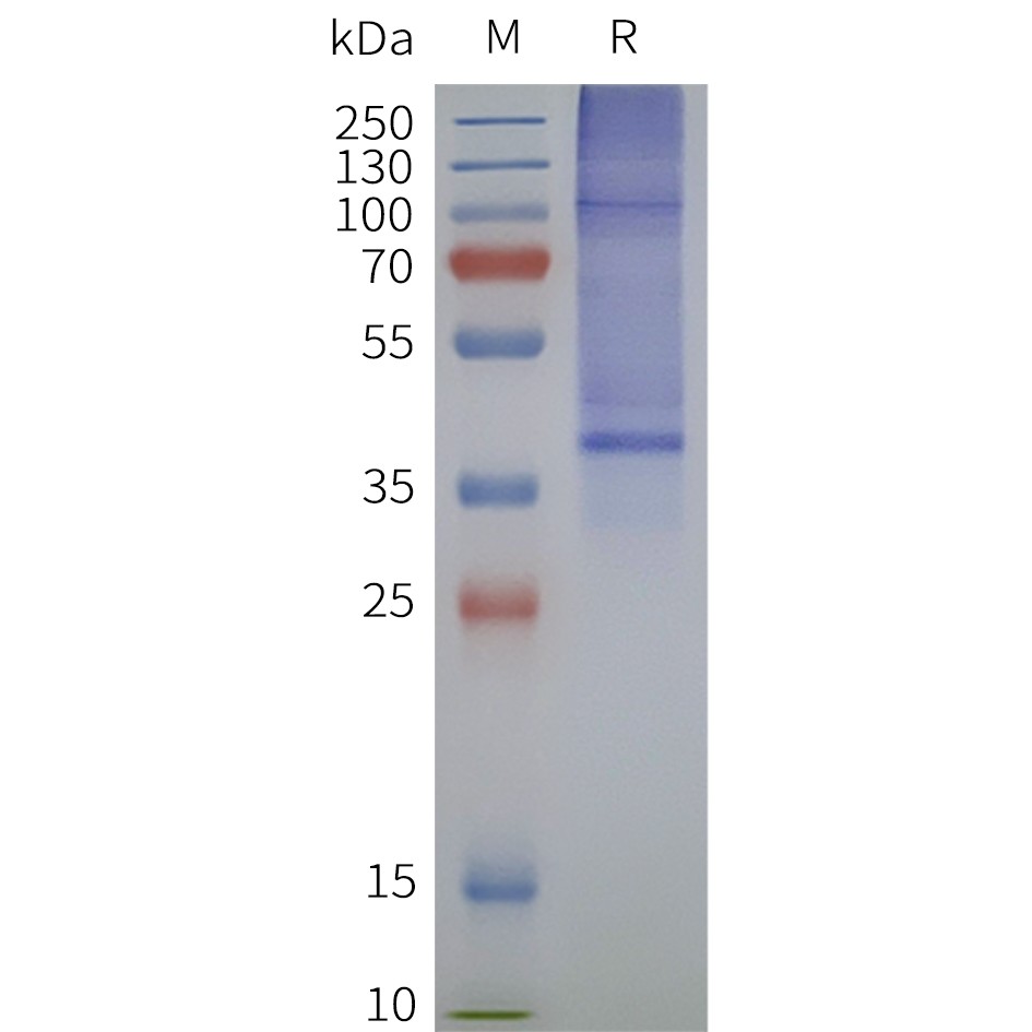 flp120382-oprd1-strep-sp1.jpg