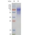 page-flp120426 hcrtr2 strep sp1