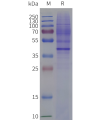 page-flp120429 oxyr strep sp1