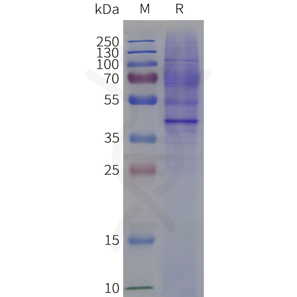 flp120429-oxyr-strep-sp1.png