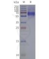 page-flp120440 pacr strep sp1