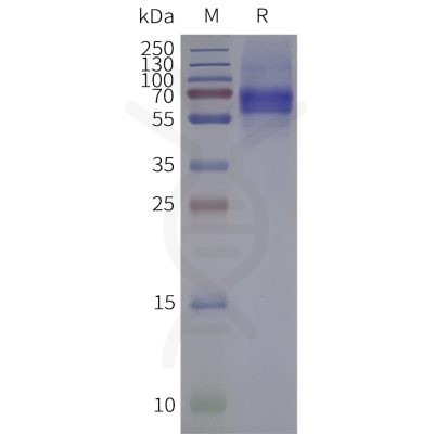 page-flp120440 pacr strep sp1