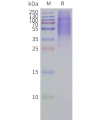 page-flp120447 ptgir strep sp1