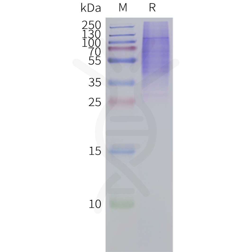 flp120447-ptgir-strep-sp1.png