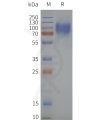 page-flp120451 pth1r strep sp1
