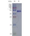 page-flp120457 rrh strep sp1