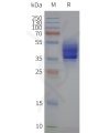 page-flp120461 s1pr2 strep sp1
