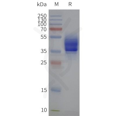 page-flp120461 s1pr2 strep sp1