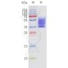 page-flp120462 s1pr3 strep sp1