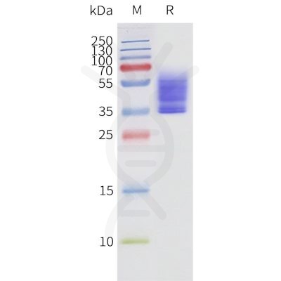 page-flp120462 s1pr3 strep sp1