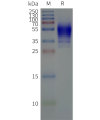 page-flp120464 s1pr5 strep sp1