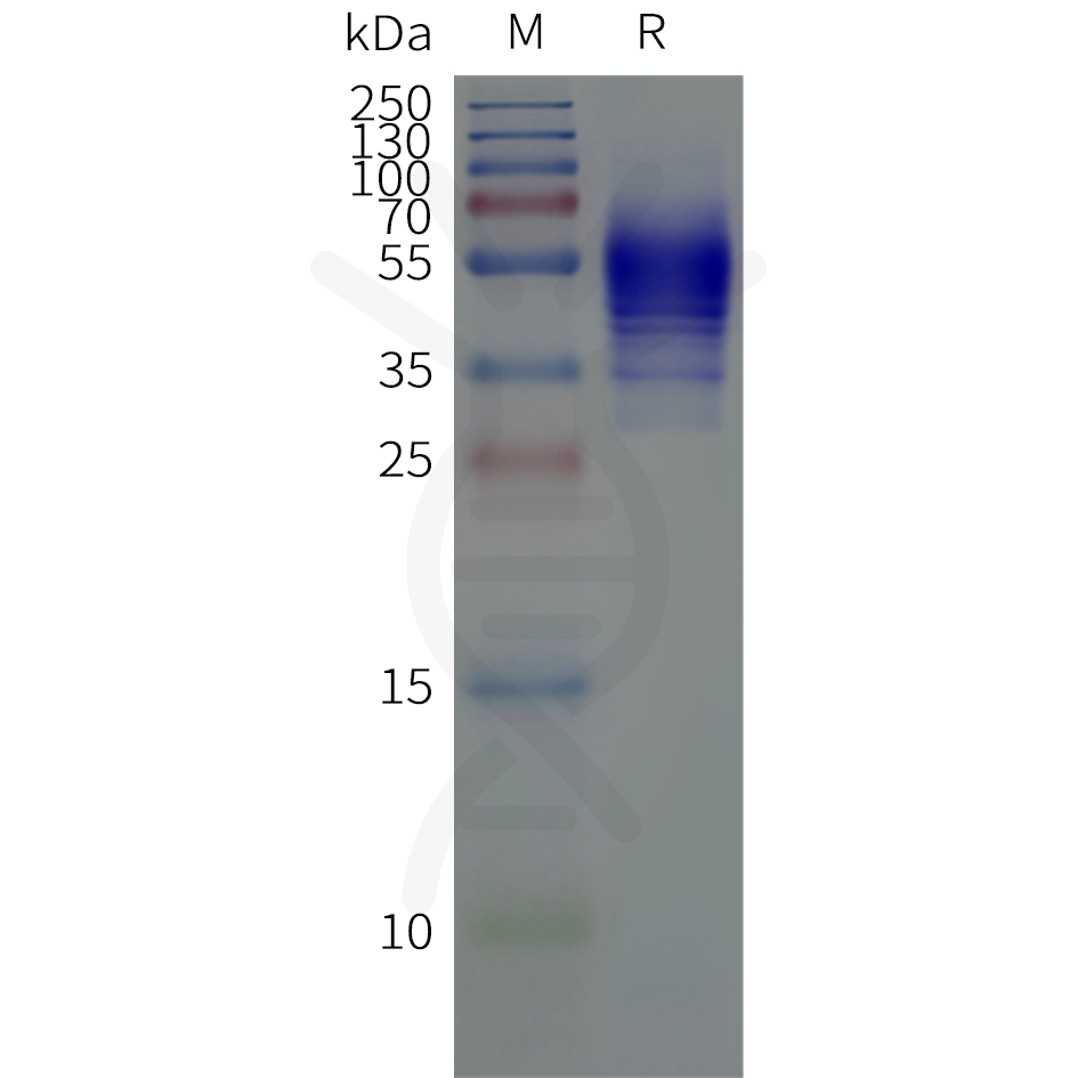 flp120464-s1pr5-strep-sp1.png