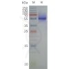 page-flp120465 sctr strep sp1