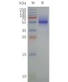 page-flp120465 sctr strep sp1