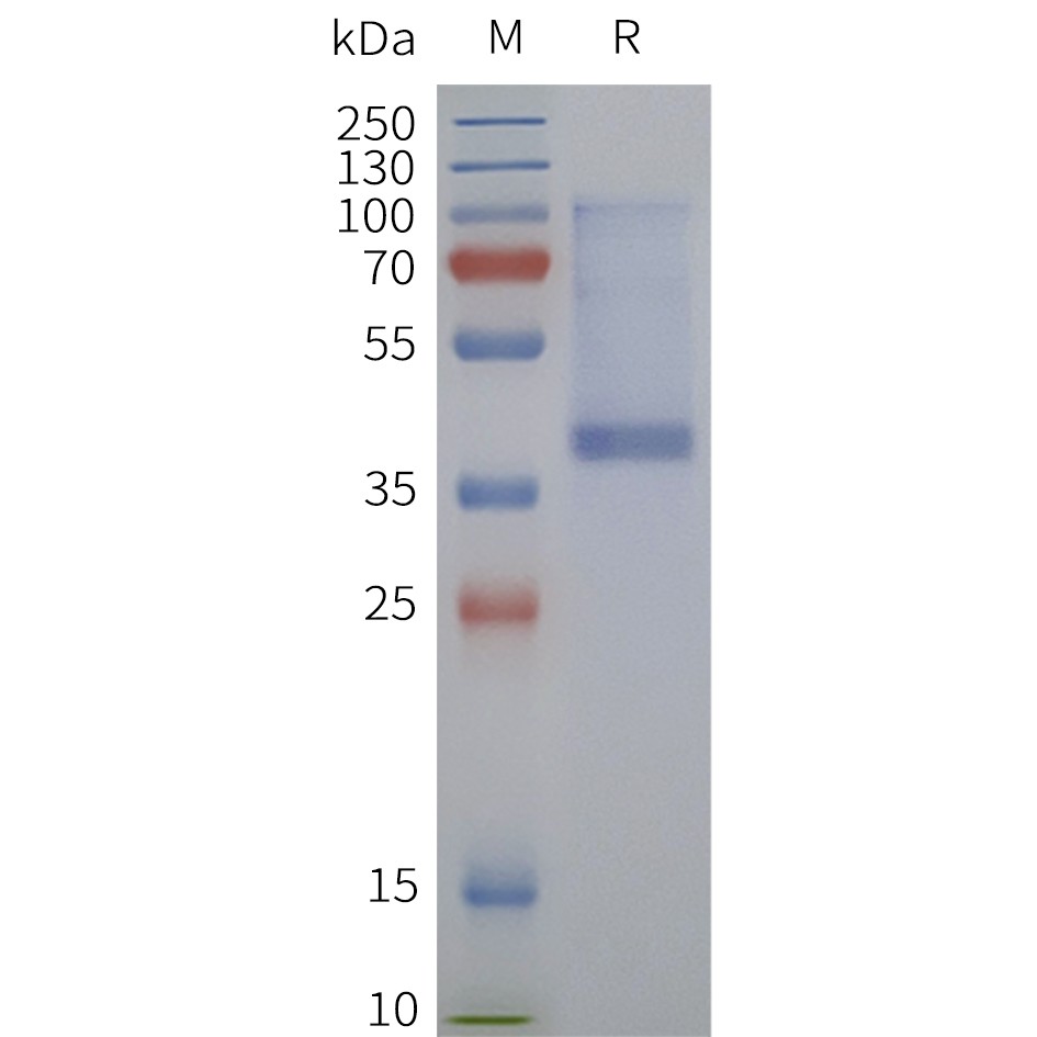 flp120467-sstr1-strep-sp1.jpg