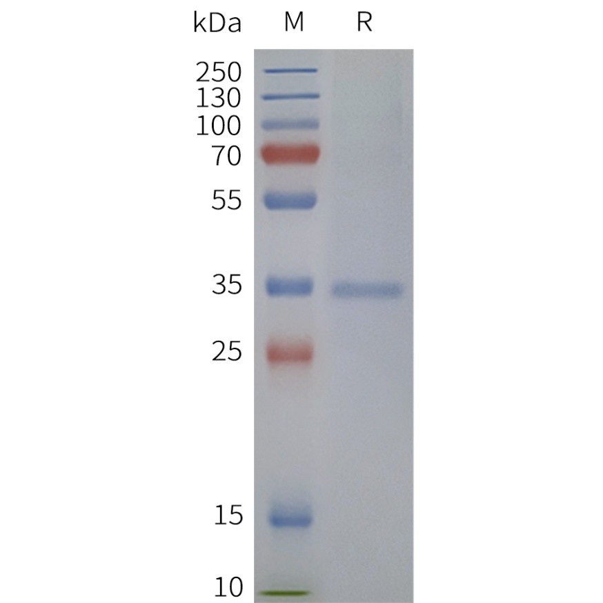 flp120473-tas2r38-strep-sp1.jpg