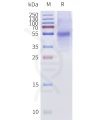 page-flp120481a bril taar1 strep sp1