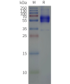 page-flp120494 vipr2 strep sp1
