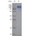 page-flp120496 slc34a2 strep sp1