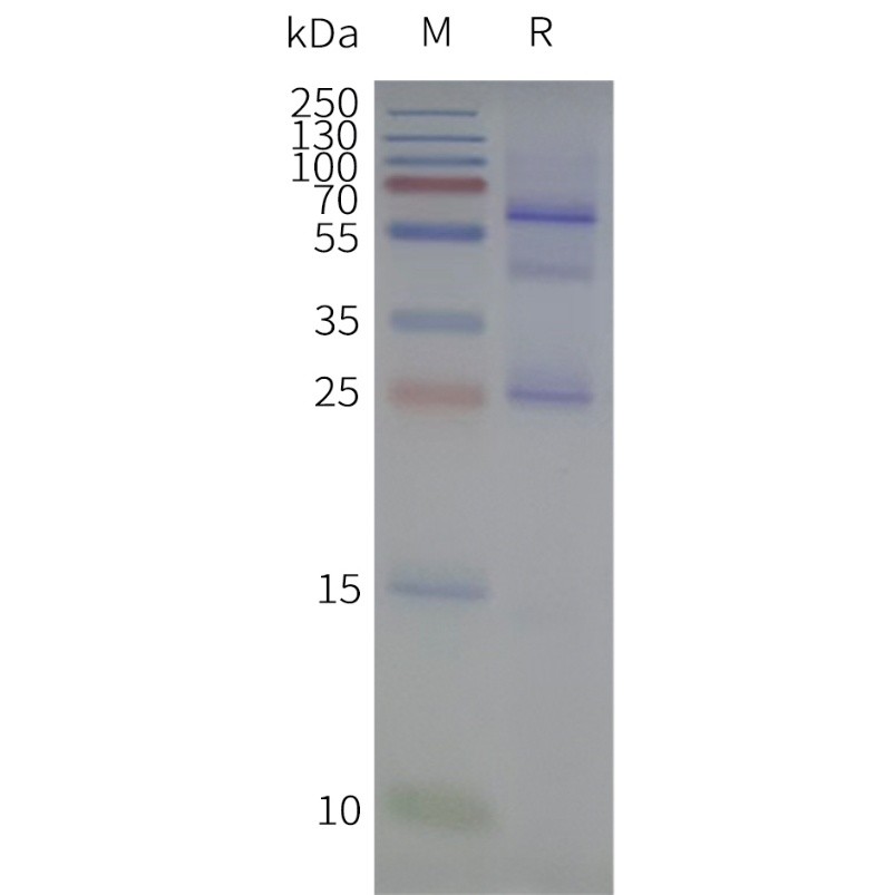 flp120503-cldn18.1-strep-sp1.jpg