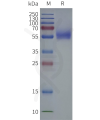 page-flp120510 slc2a1 strep sp1