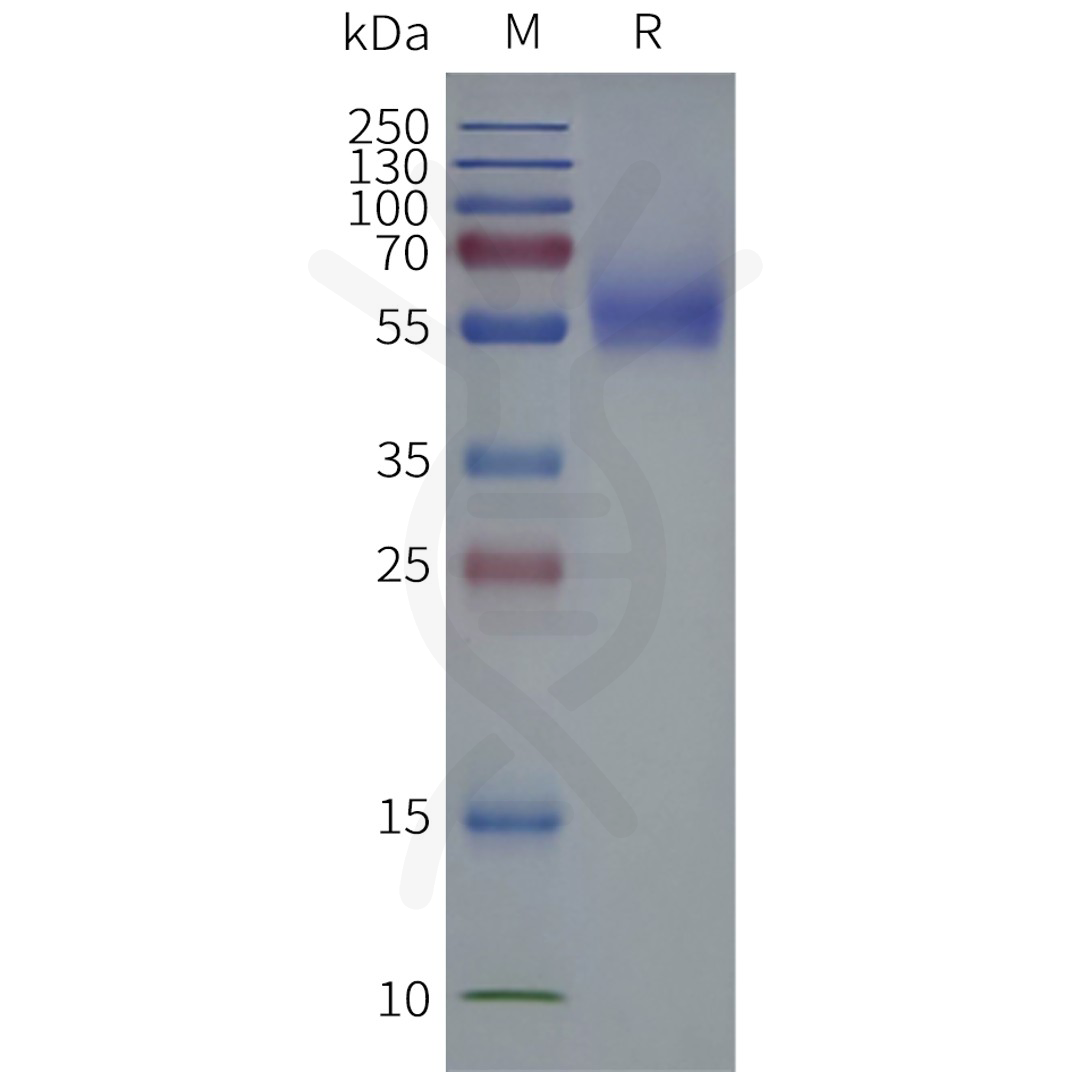 flp120510-slc2a1-strep-sp1.png